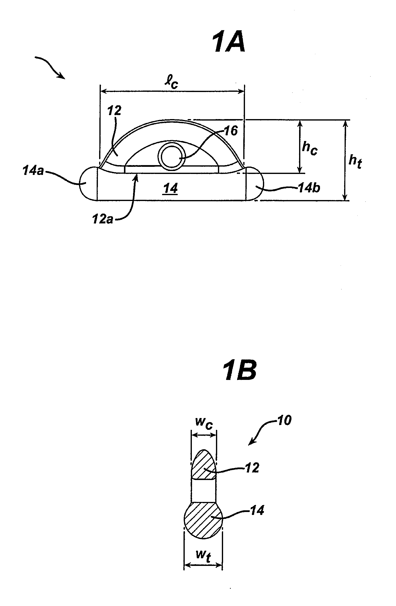 Methods and devices for repairing triangular fibrocartilage complex tears