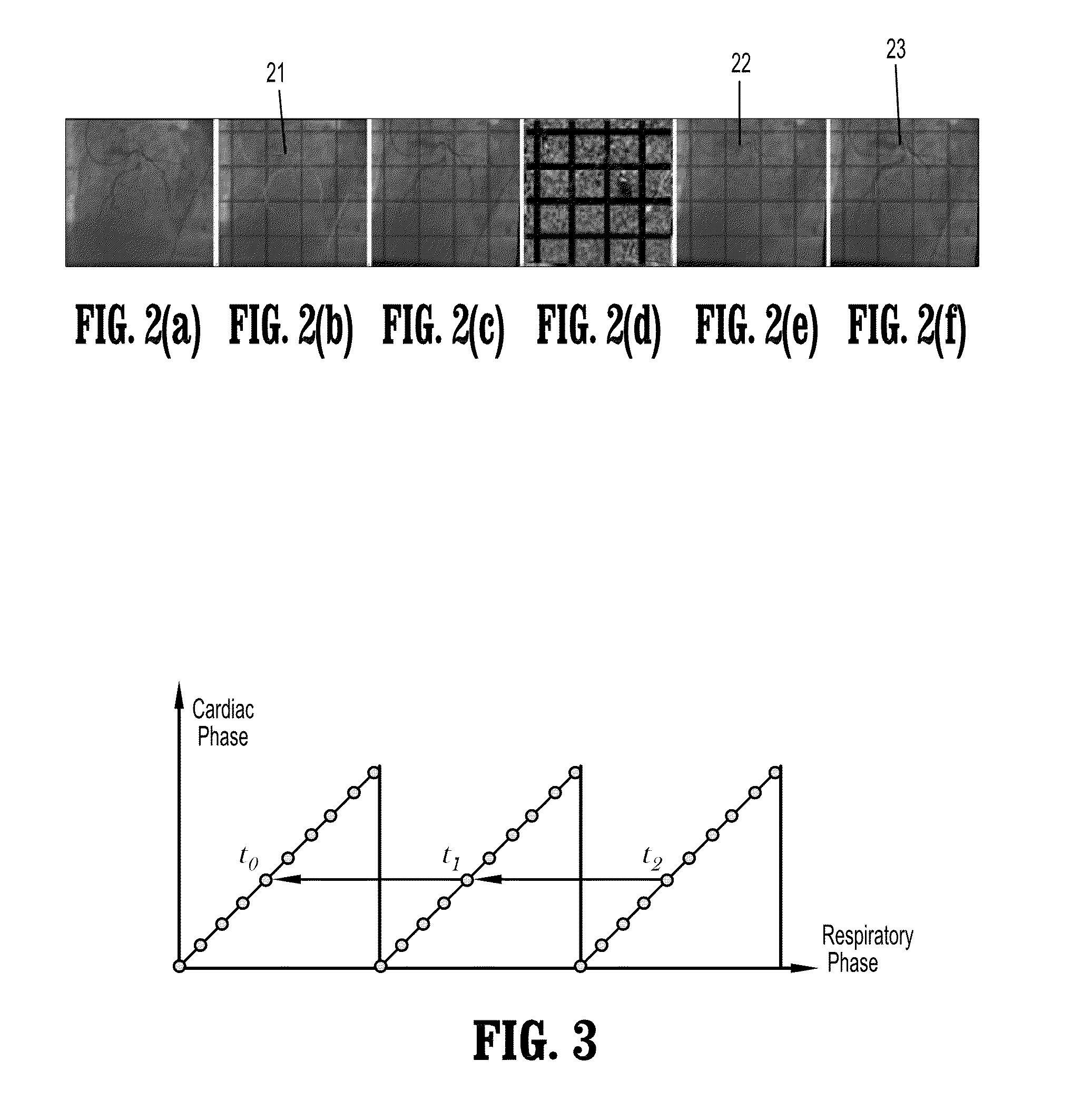 System and method for image-based respiratory motion compensation for fluoroscopic coronary roadmapping