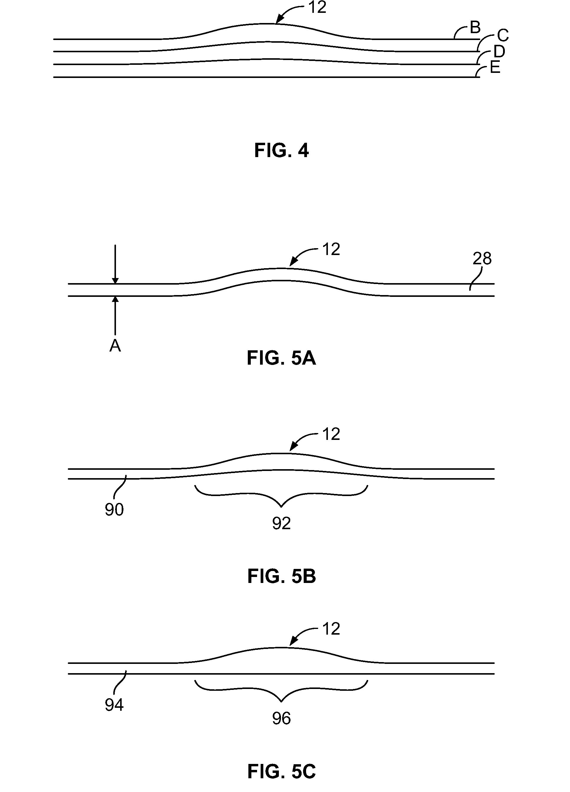 Stent device for anastomoses of blood vessels and other tubular organs