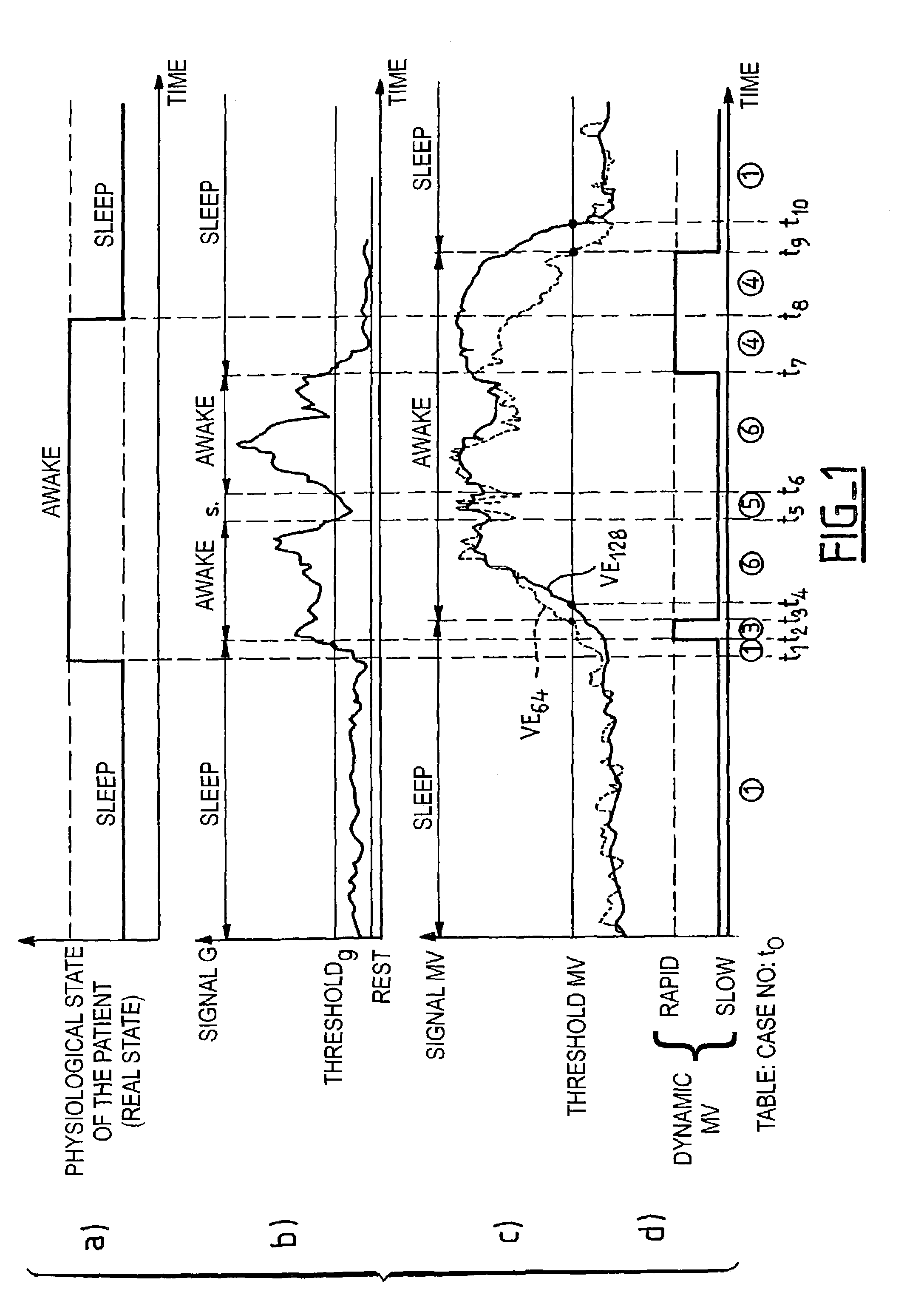 Detection and the treatment of ventilatory disorders during sleep for an active implantable medical device, in particular a pacemaker