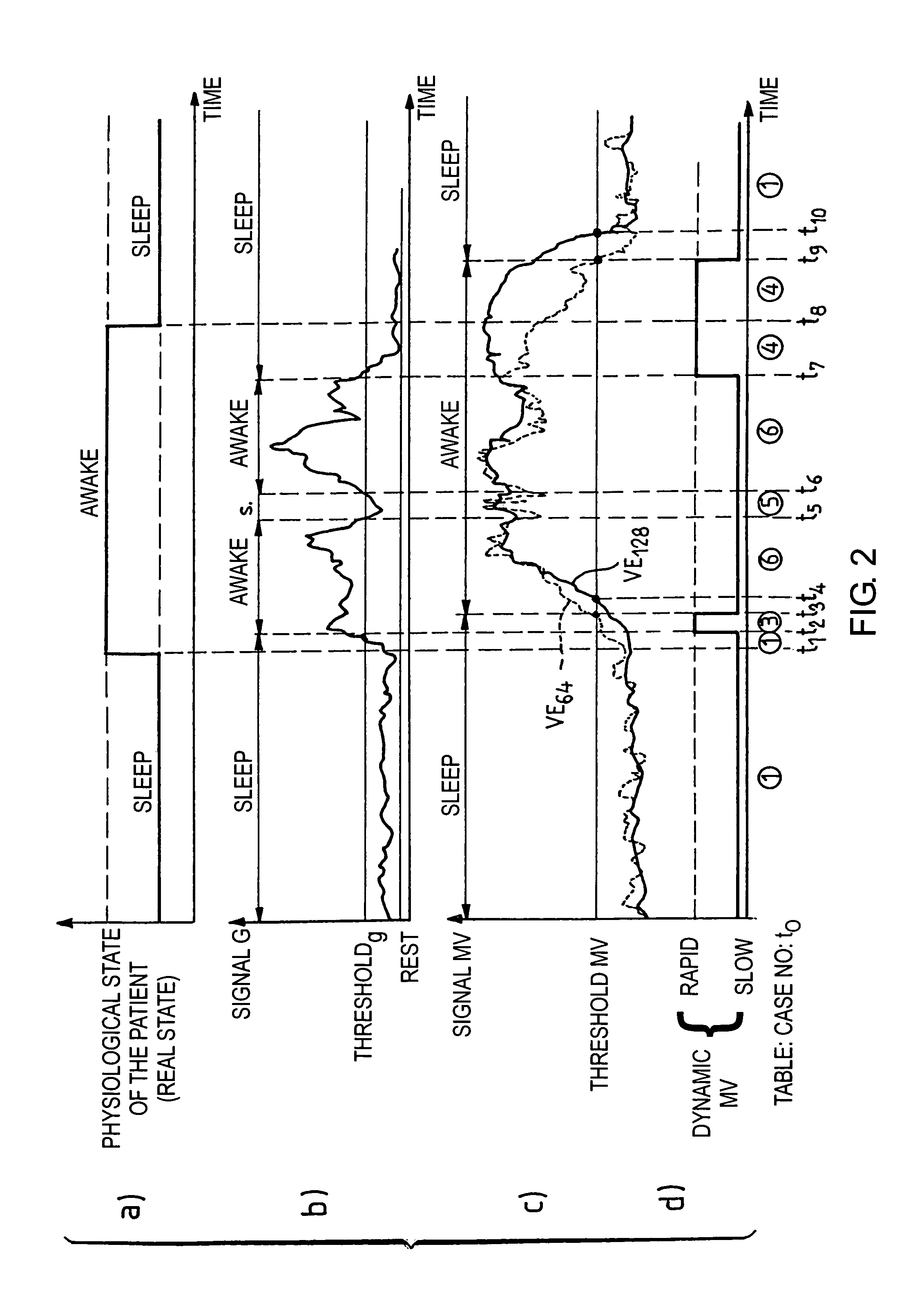 Detection and the treatment of ventilatory disorders during sleep for an active implantable medical device, in particular a pacemaker