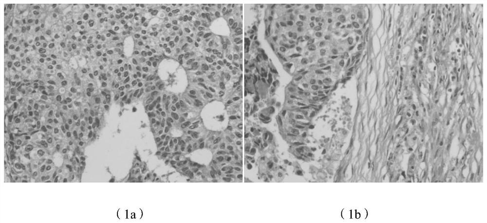 A kind of pathological tissue transparent dewaxing liquid and preparation method thereof