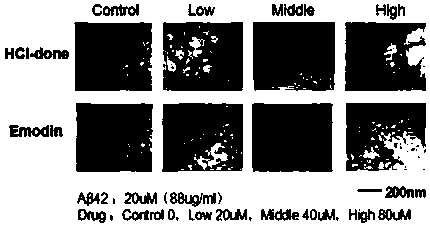 Application of compound in treatment of senile dementia by inhibiting amyloid protein accumulation