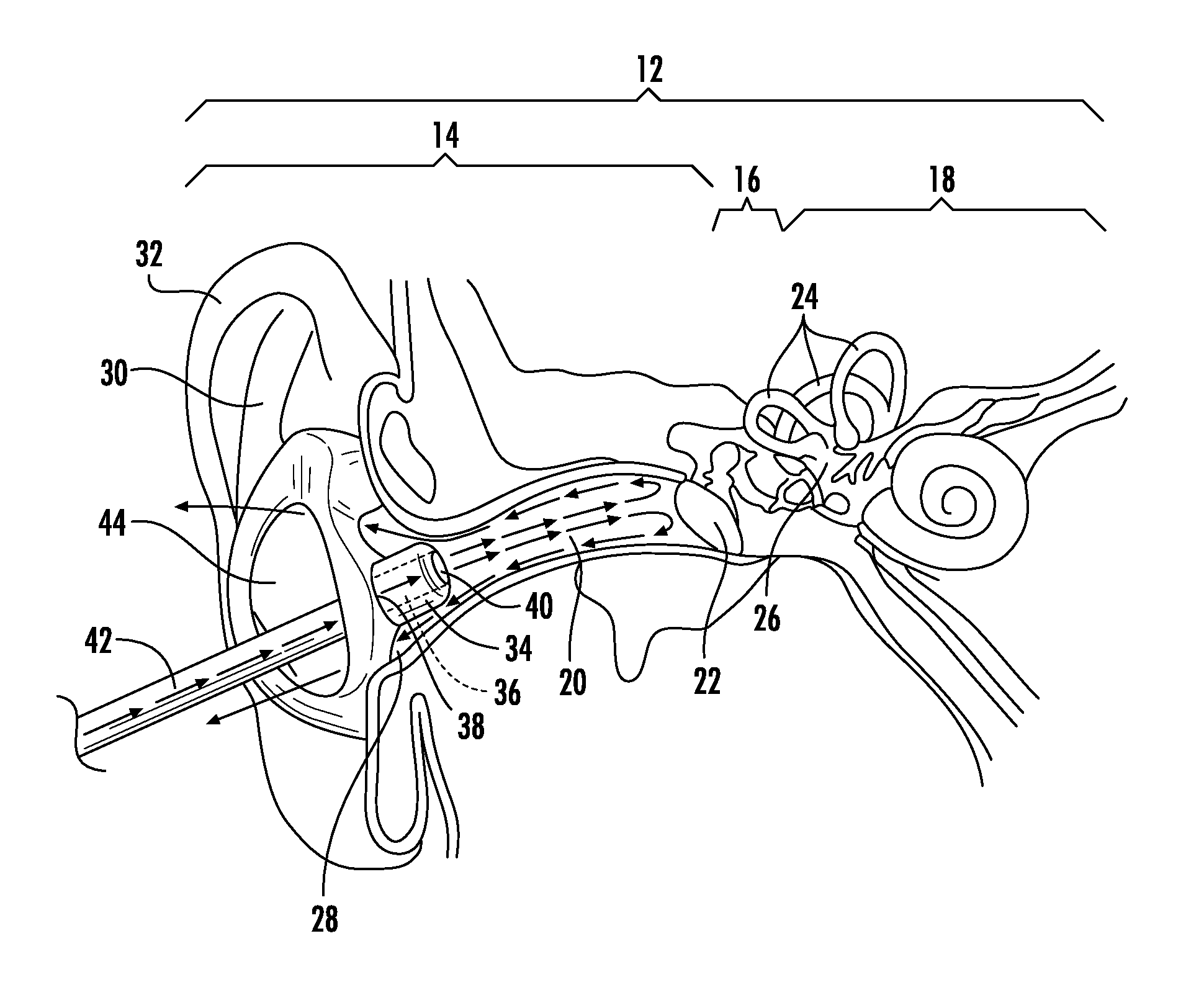 Apparatus for Preventing Motion Sickness and Related Method