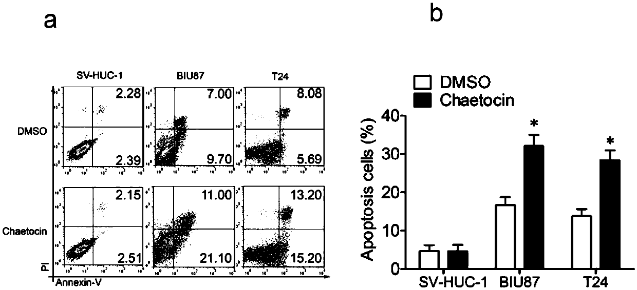 Application of KMT1A inhibitor in preparation of anticancer drug for bladder cancers