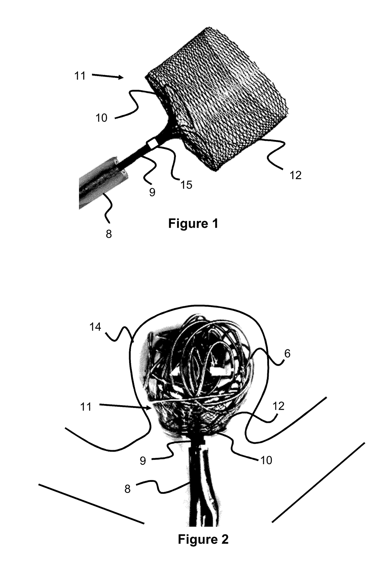 Devices for Vascular Occlusion