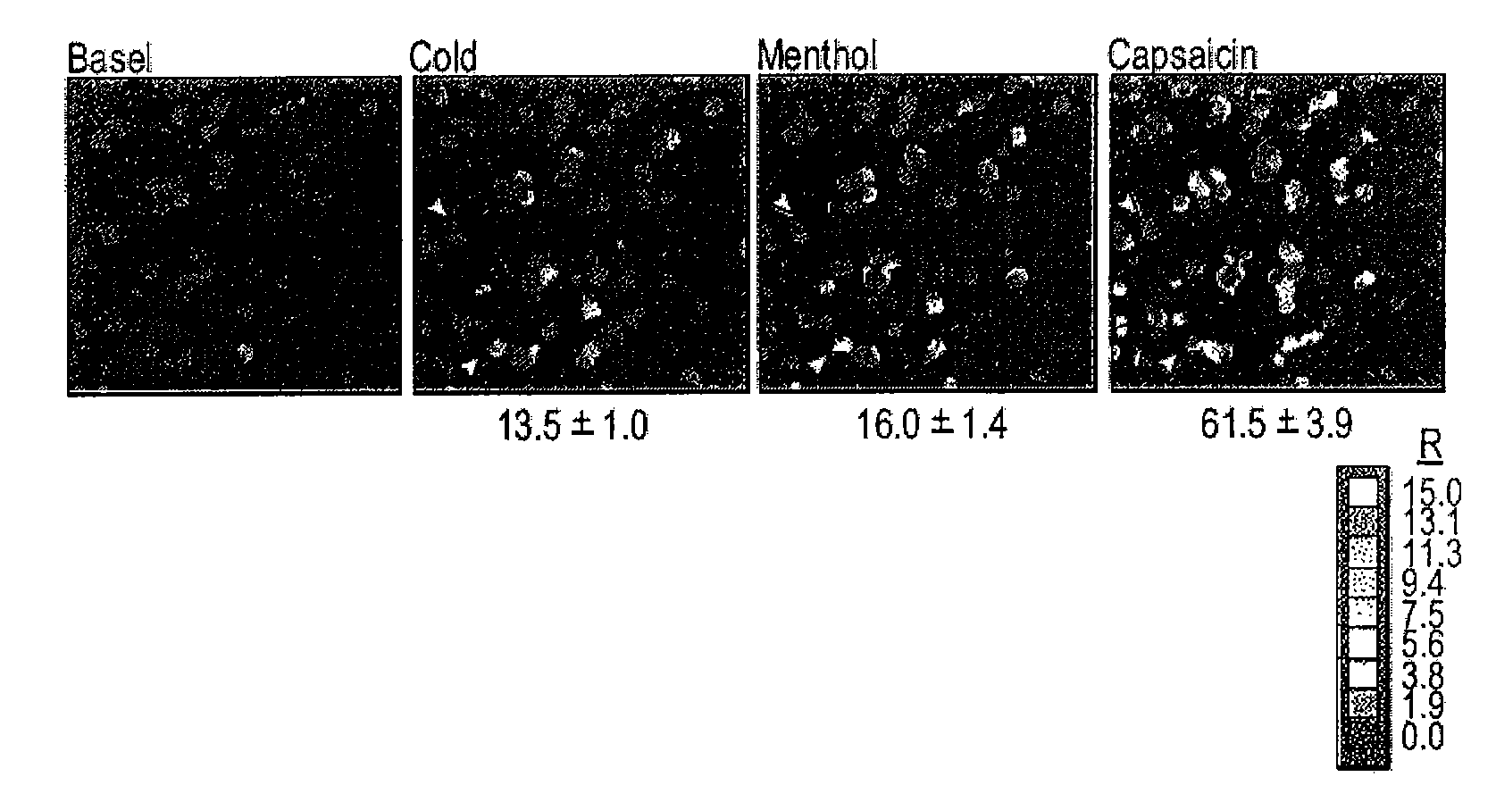 Methods of modulating cold sensory perception