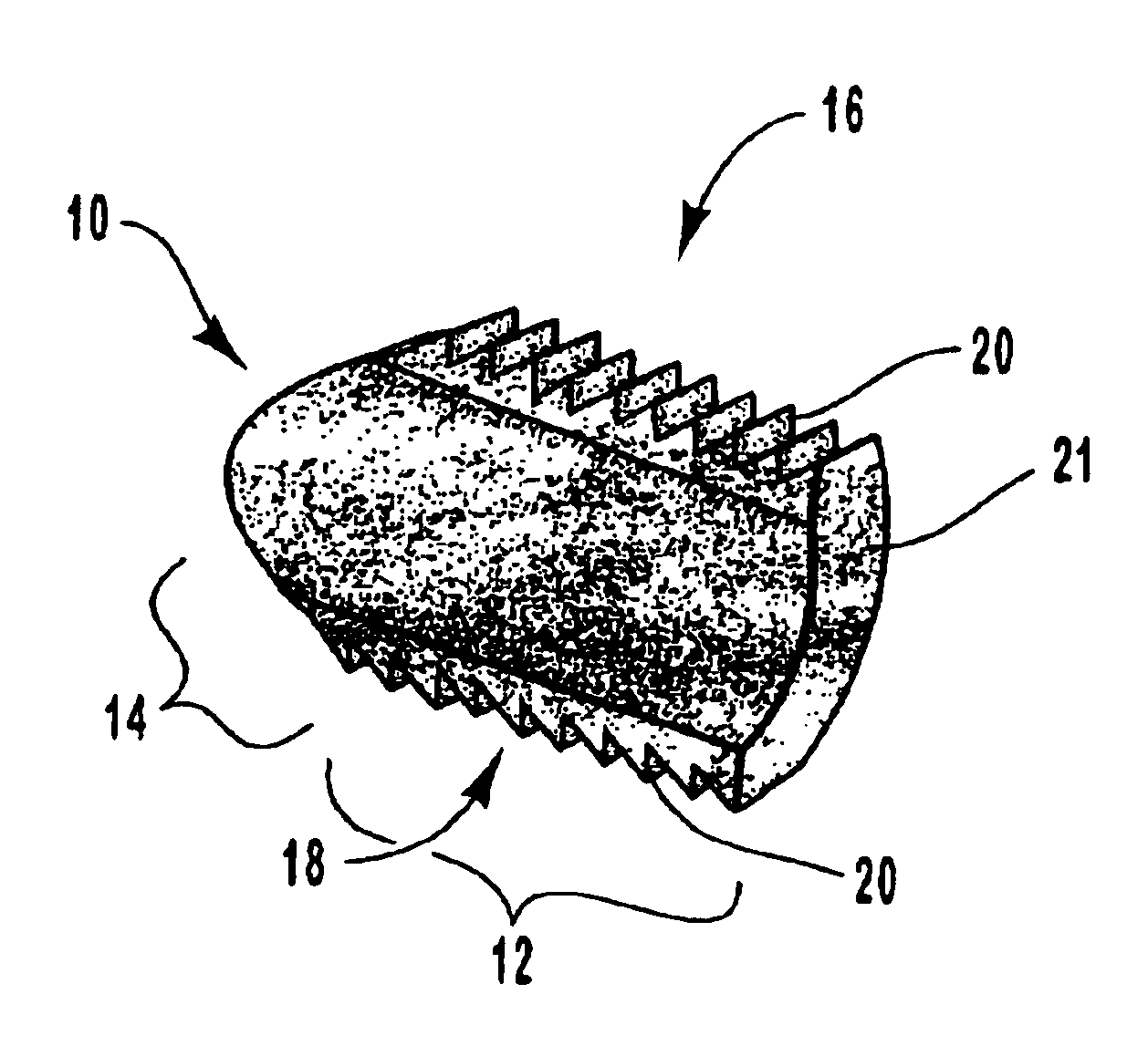 Spinal vertebral implant and methods of insertion