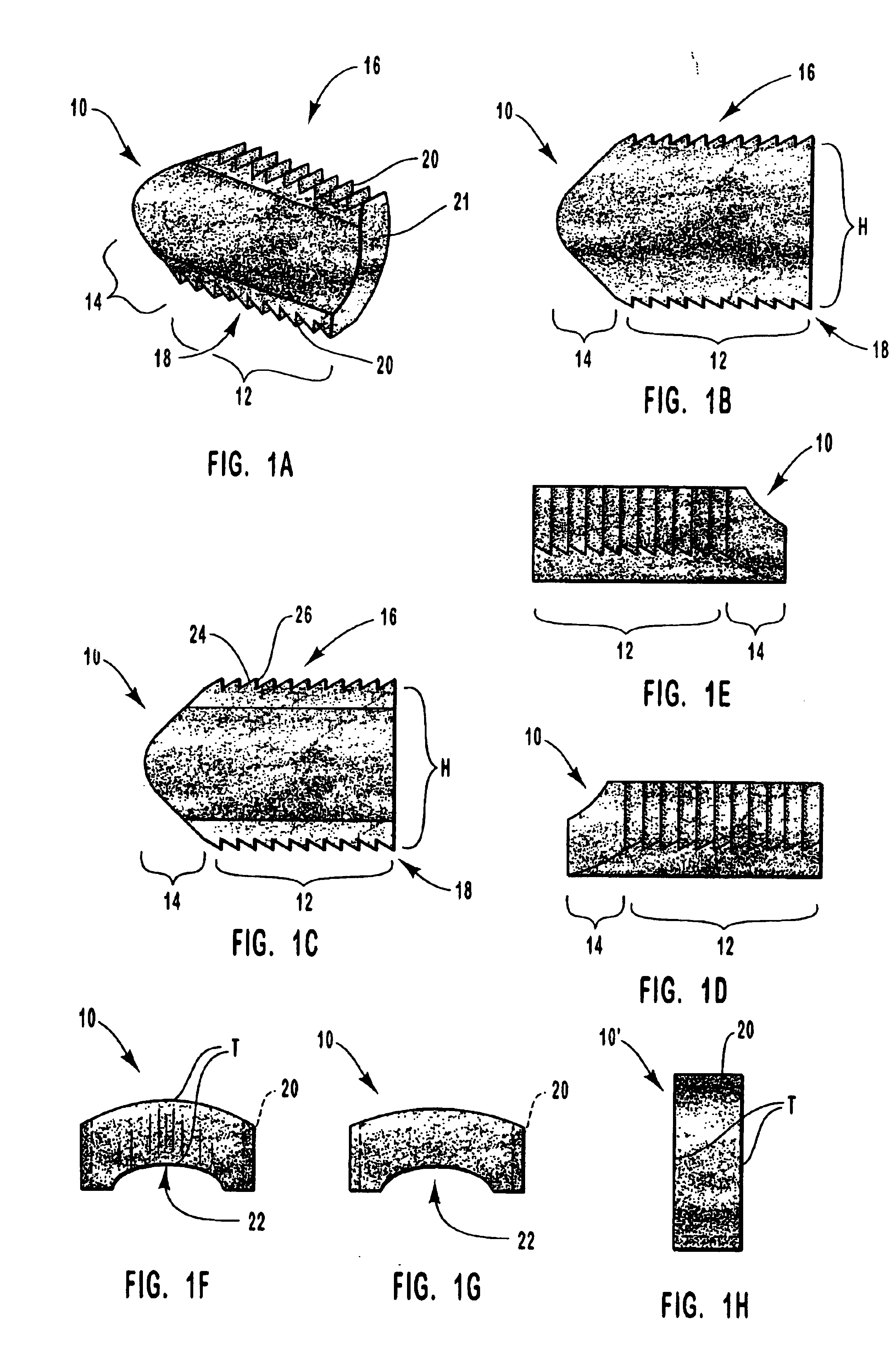 Spinal vertebral implant and methods of insertion