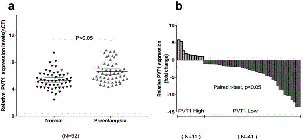 Long non-coding RNA (Ribonucleic Acid) and application thereof in diagnosis/treatment of preeclampsia