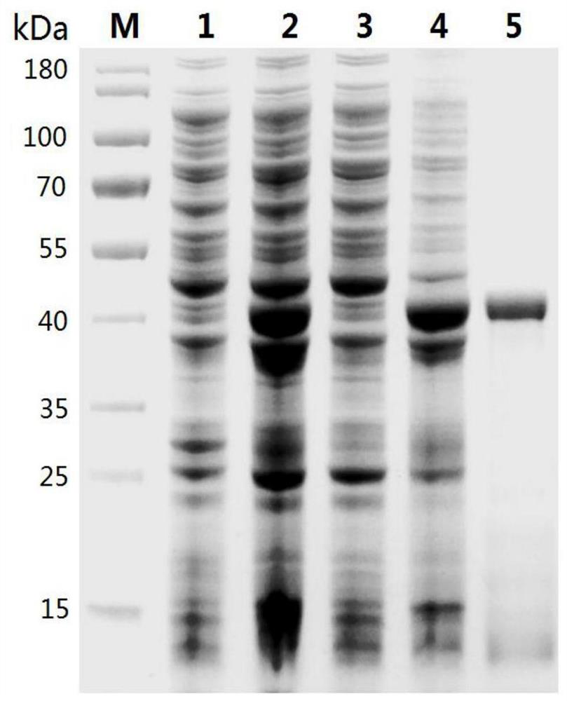 Schistosoma mansoni recombinant fusion protein SmSAP and application thereof to schistosomiasis immunodiagnosis