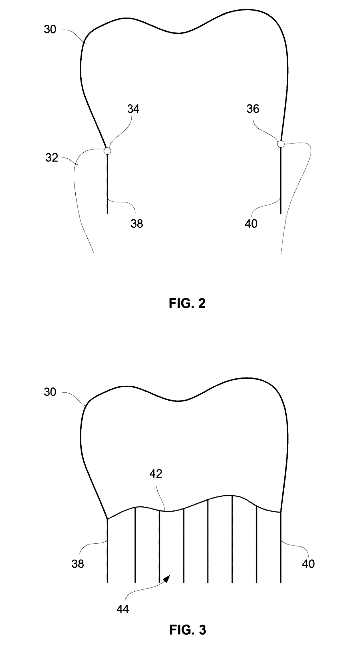 Systems and methods for fabricating dental appliances or shells