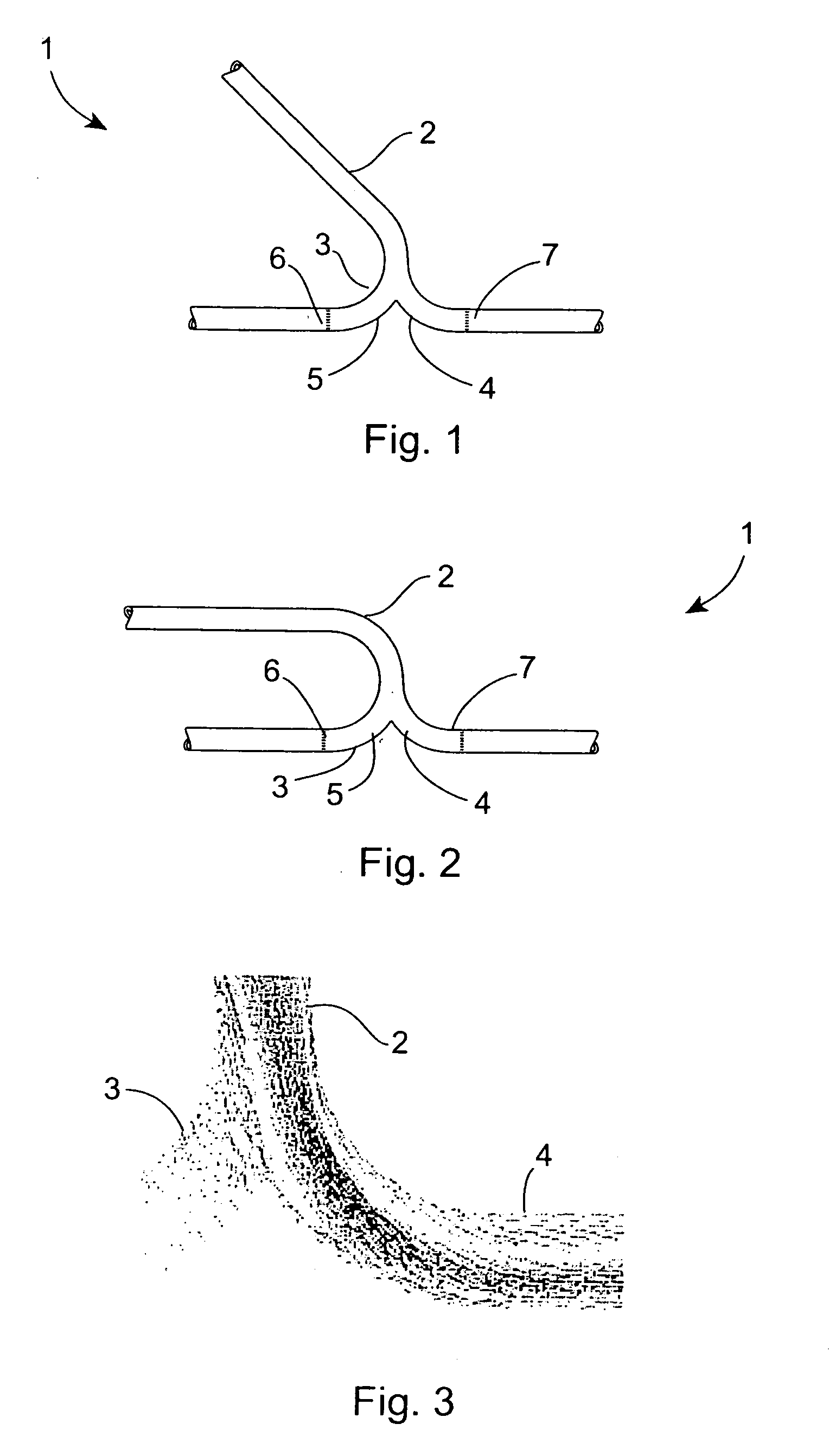 Vascular graft