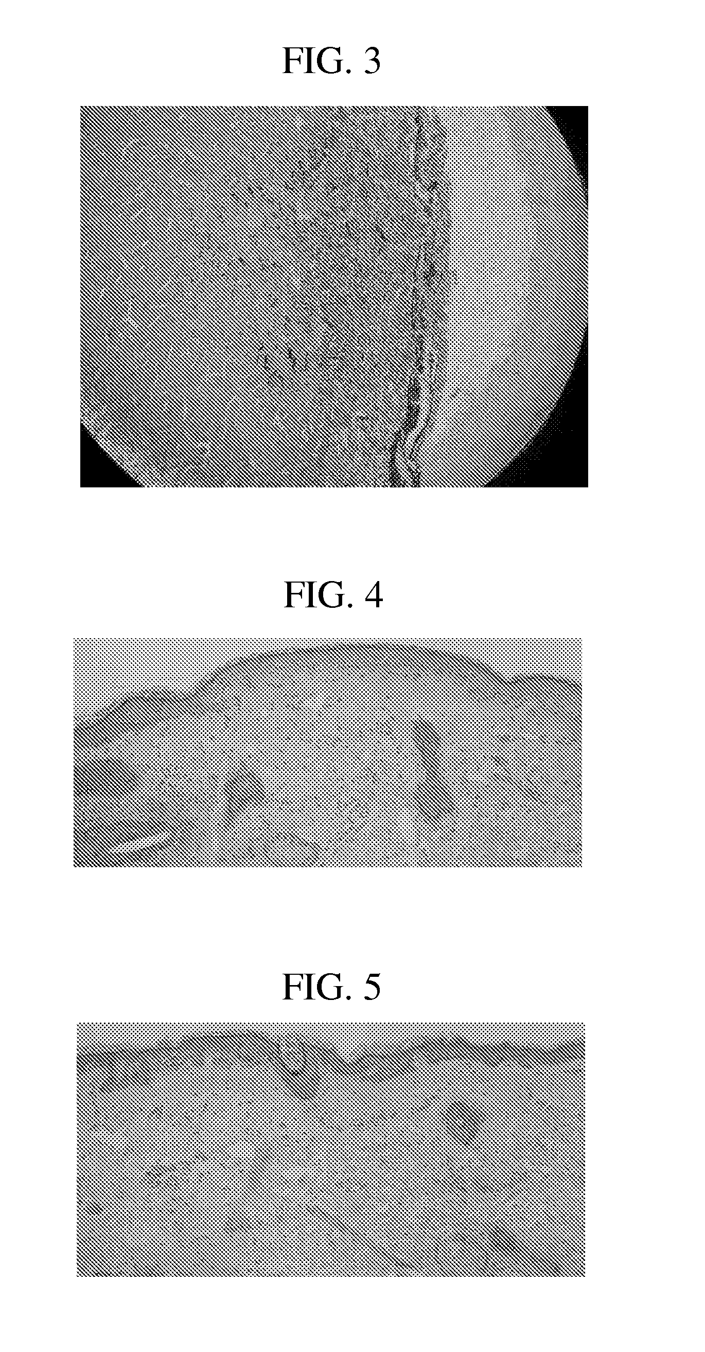 Skin Resurfacing at 1930 NM