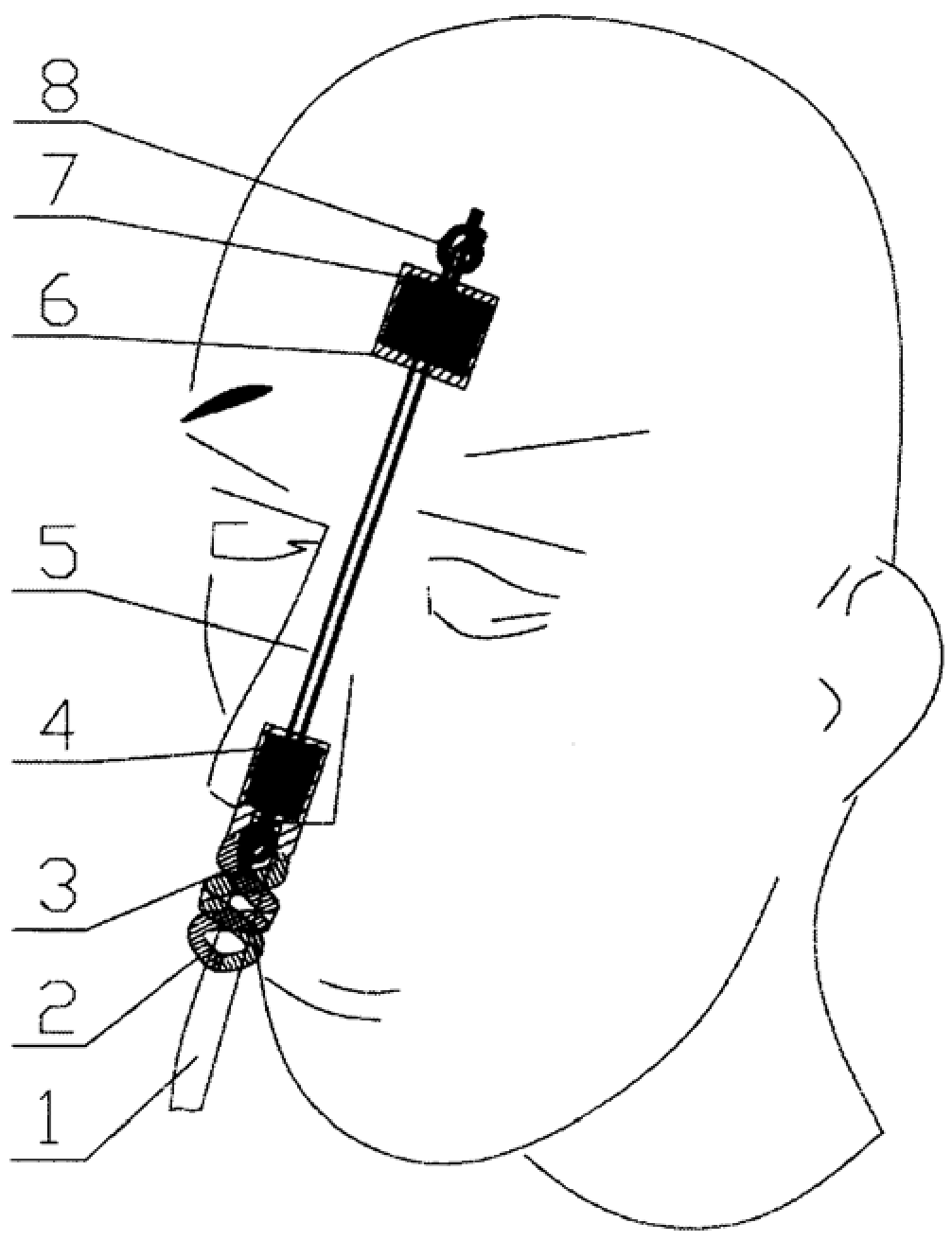 Nasogastric tube double-fixing anti-pressing device and using method thereof