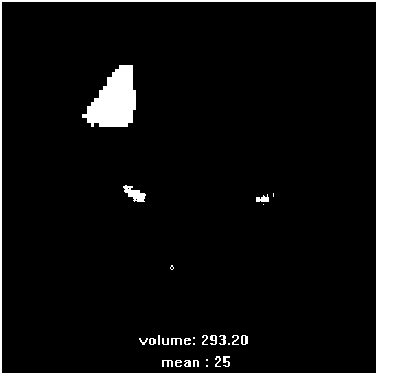 Quantitative analysis software for pulmonary perfusion and ventilation tomography