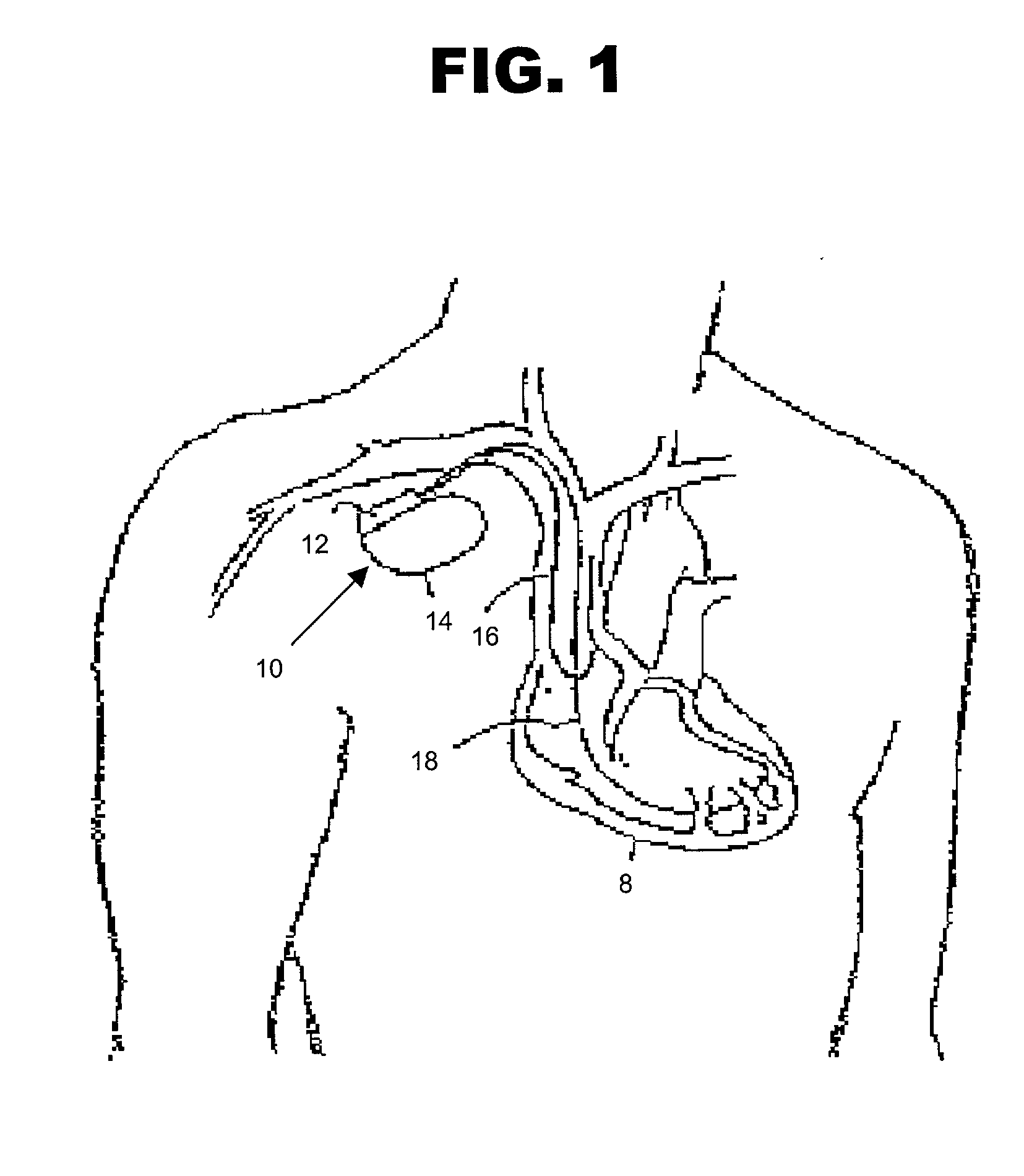 Rate adaptive pacemaker system with dual sensing component and method of using same