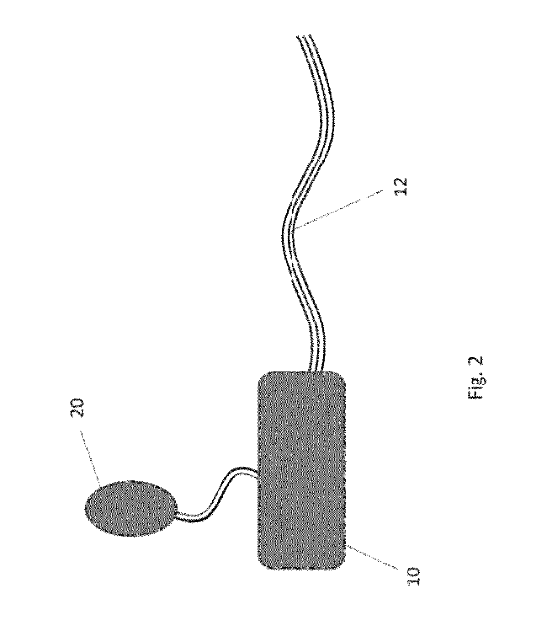 Continuous blood glucose monitor