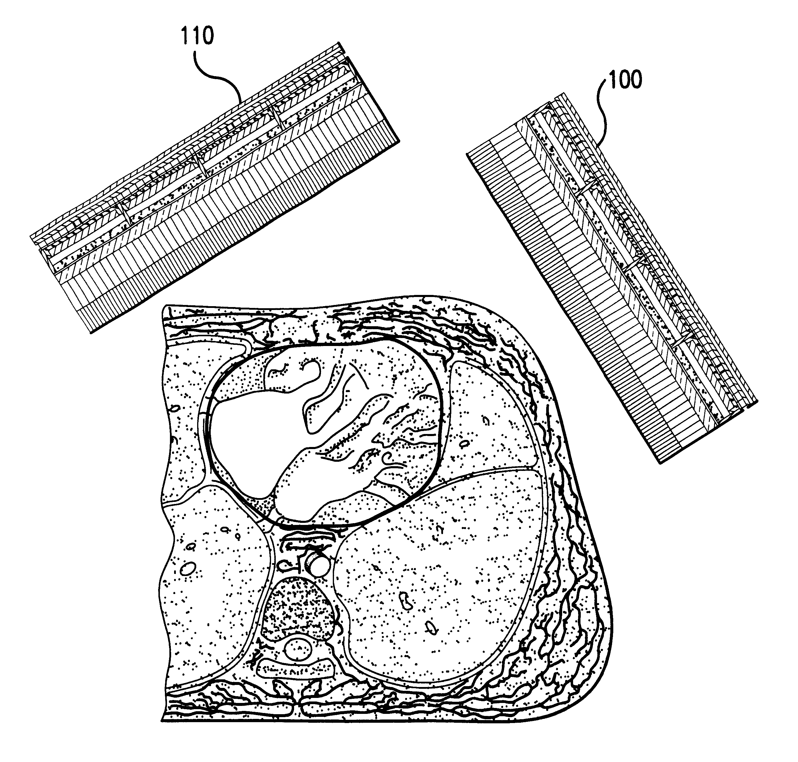 Cardiovascular imaging and functional analysis system