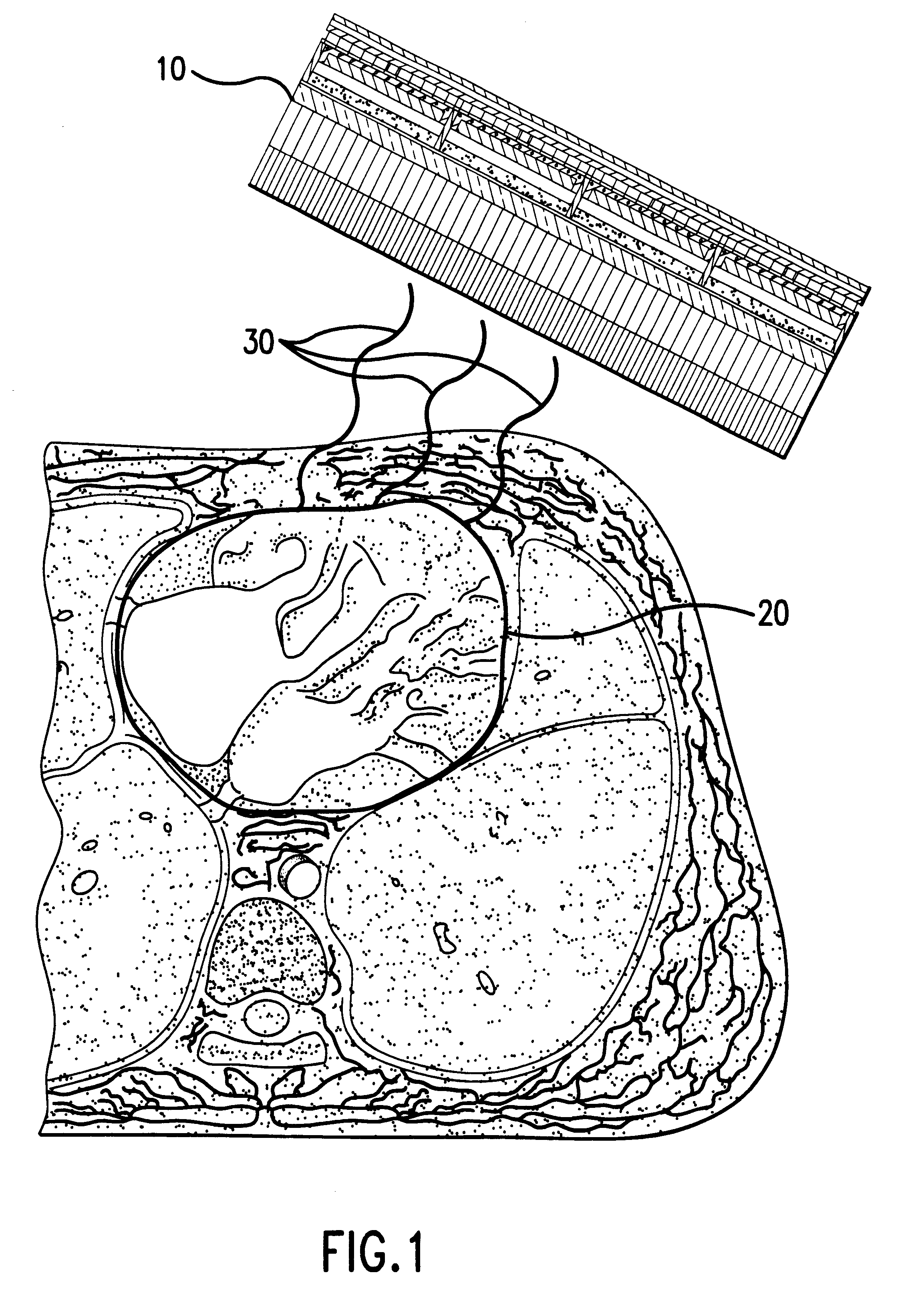 Cardiovascular imaging and functional analysis system