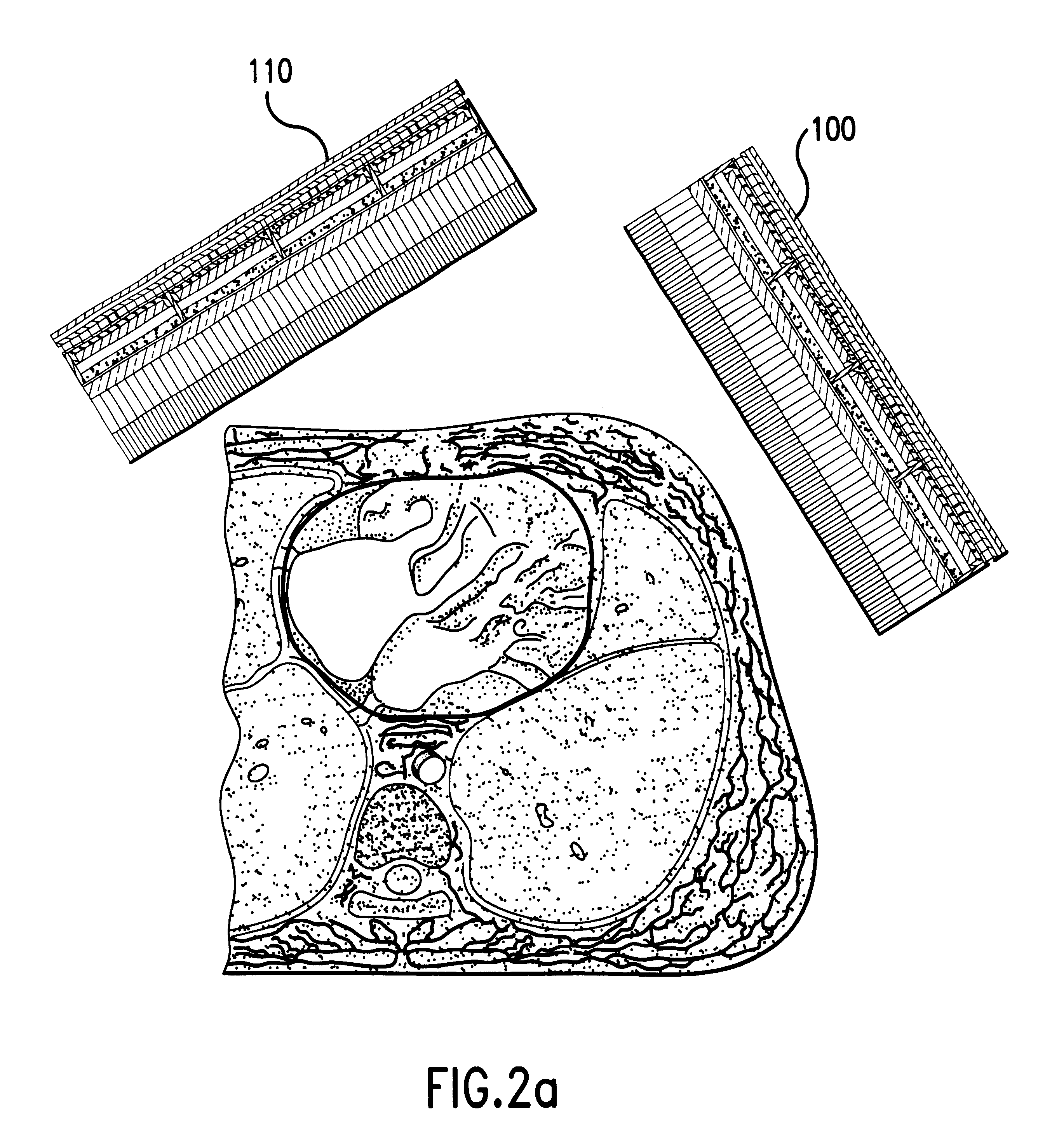 Cardiovascular imaging and functional analysis system