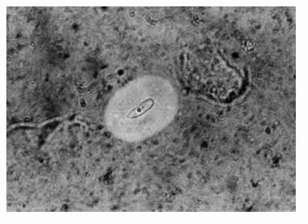 Cryptococcus gattii, and isolated culture method and application thereof