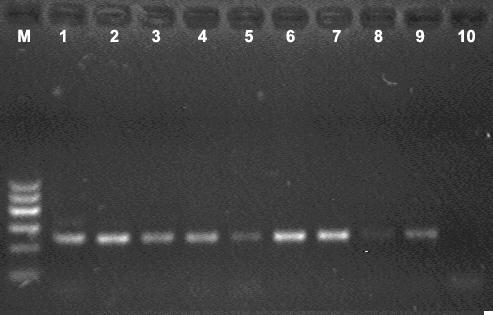 Polymerase chain reaction (PCR) kit capable of rapidly detecting cervus derived products and preparation method