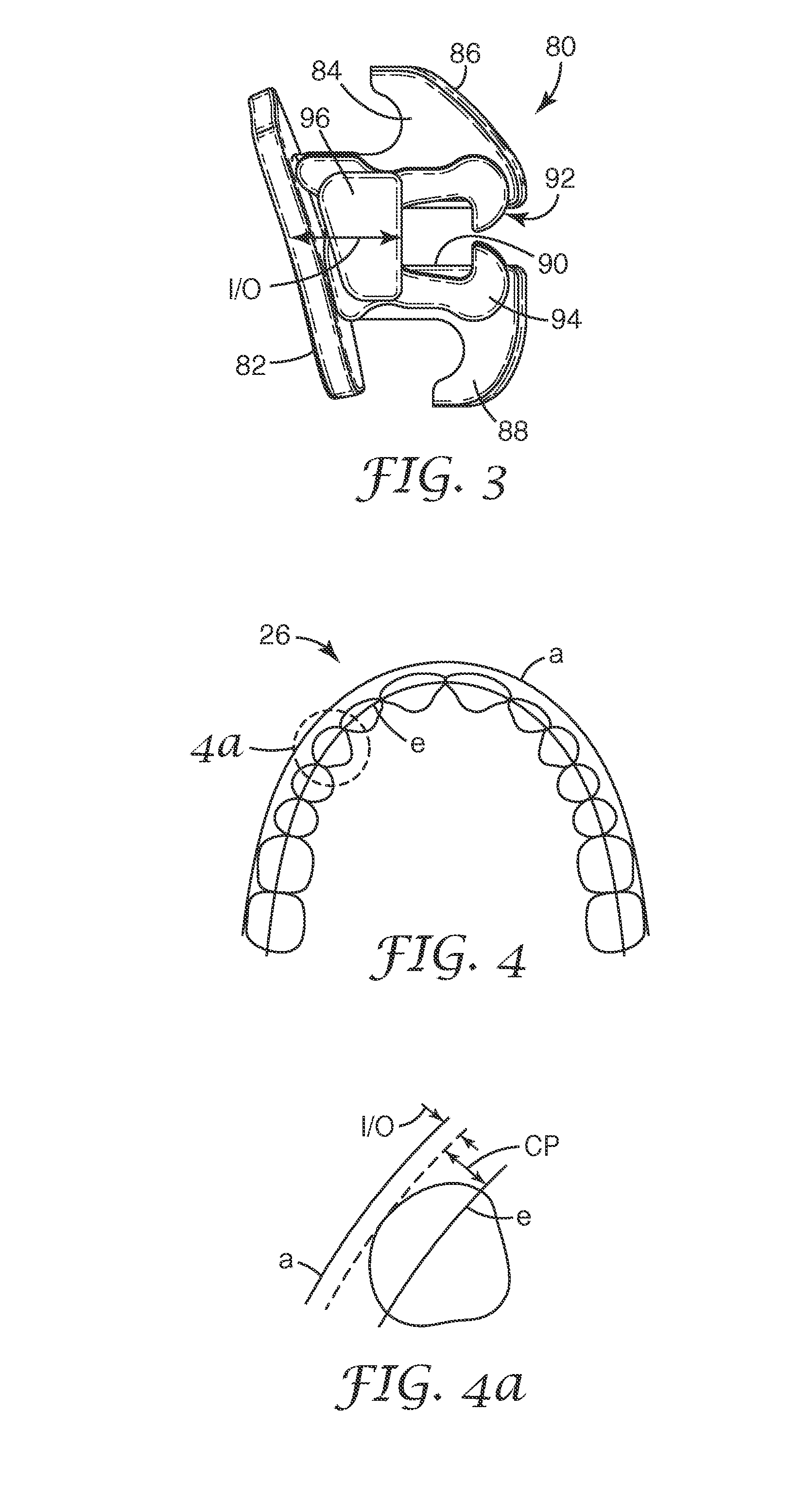 Orthodontic brace with coordinated bracket profiles