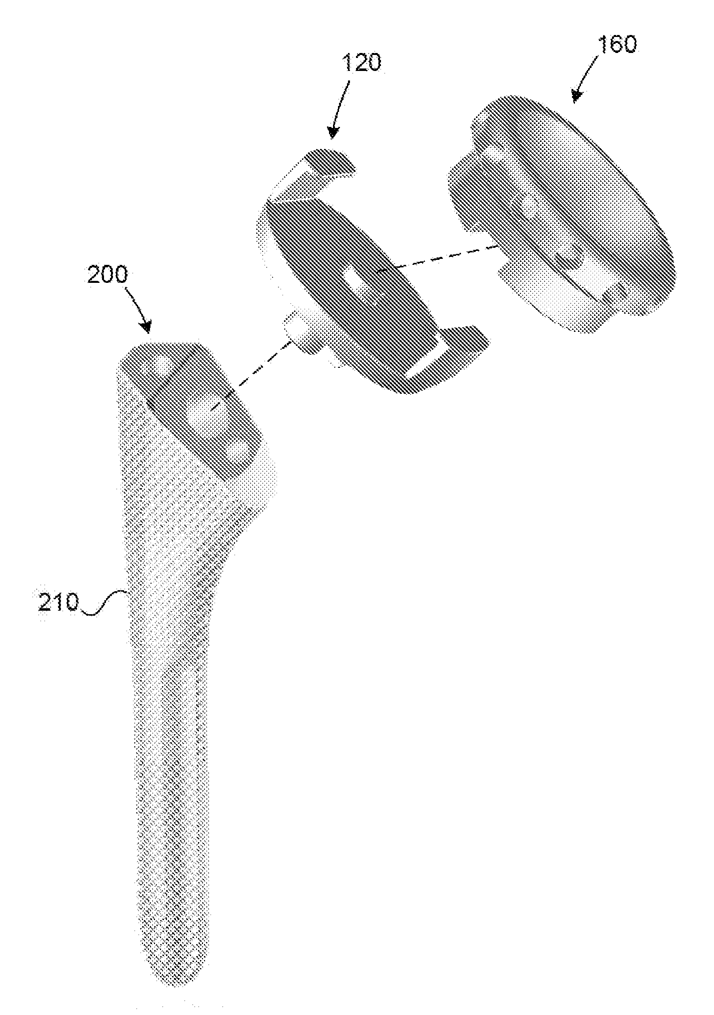 Lateral entry insert for cup trial