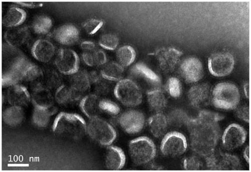 Preparation method of tetravalent influenza virus split vaccine