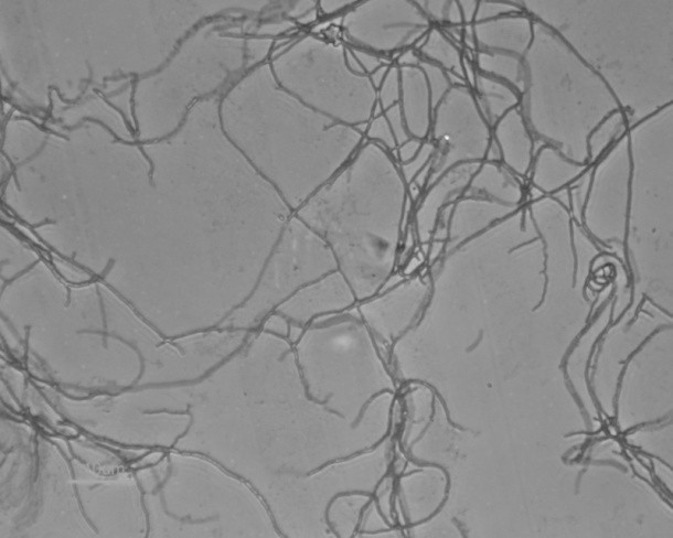 Streptomyces hawaii and application thereof