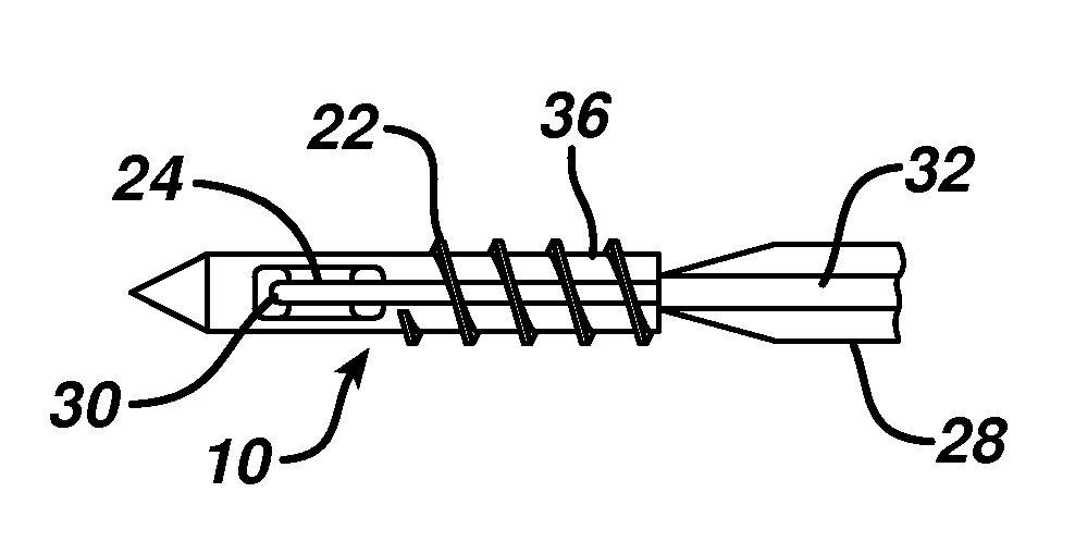 Cannula system and method for partial thickness rotator cuff repair