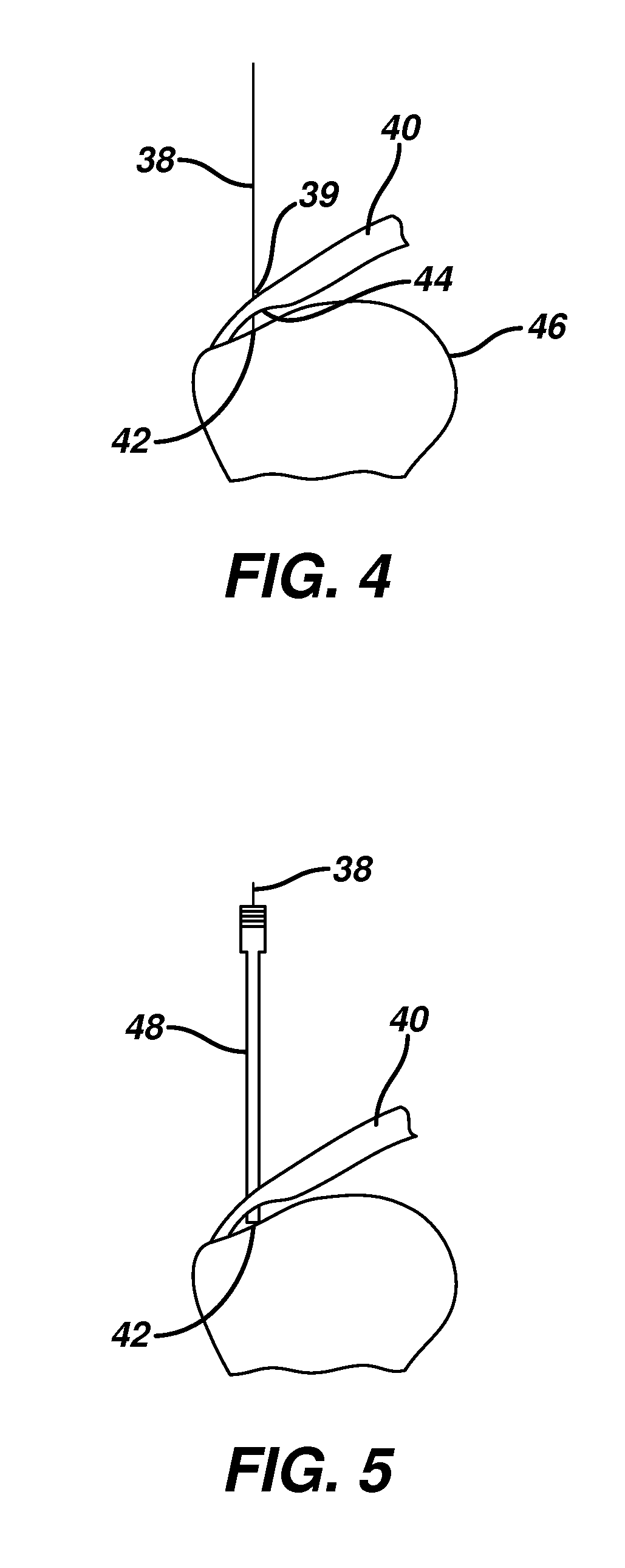 Cannula system and method for partial thickness rotator cuff repair