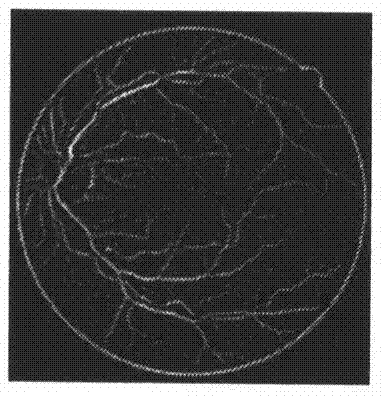 A Vessel Segmentation Method of Fundus Image Based on Adaptive Difference of Gaussian