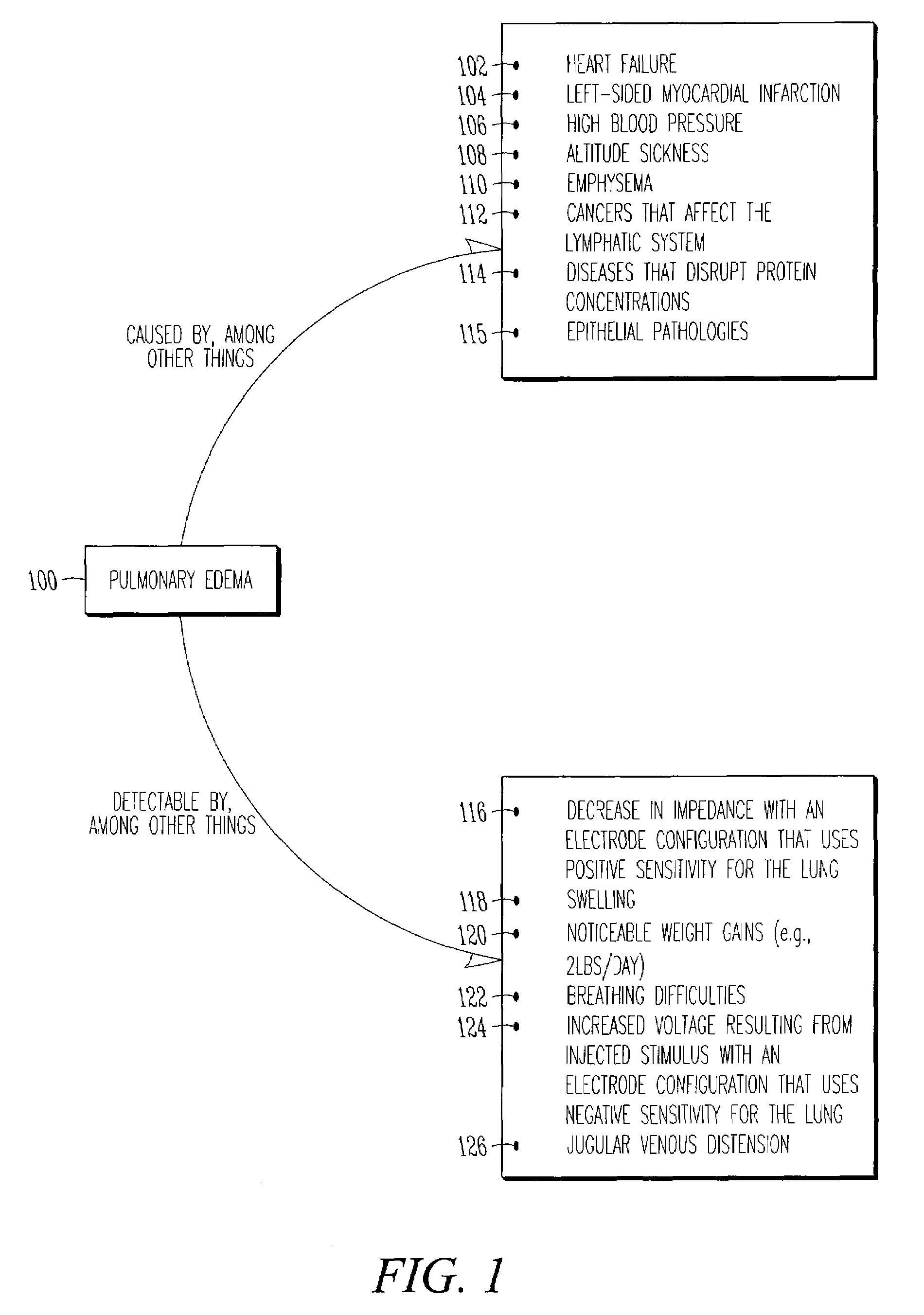 Monitoring fluid in a subject using an electrode configuration providing negative sensitivity regions