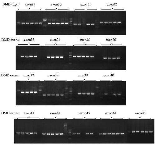 Test kit of preimplantation embryonic genetic diagnosis and prenatal diagnosis for DMD