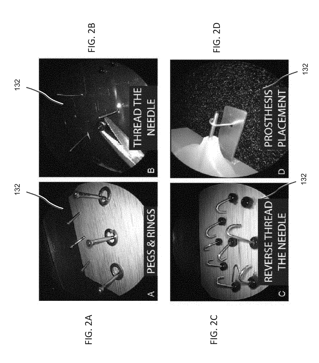 Systems and methods for otologic surgical skills training