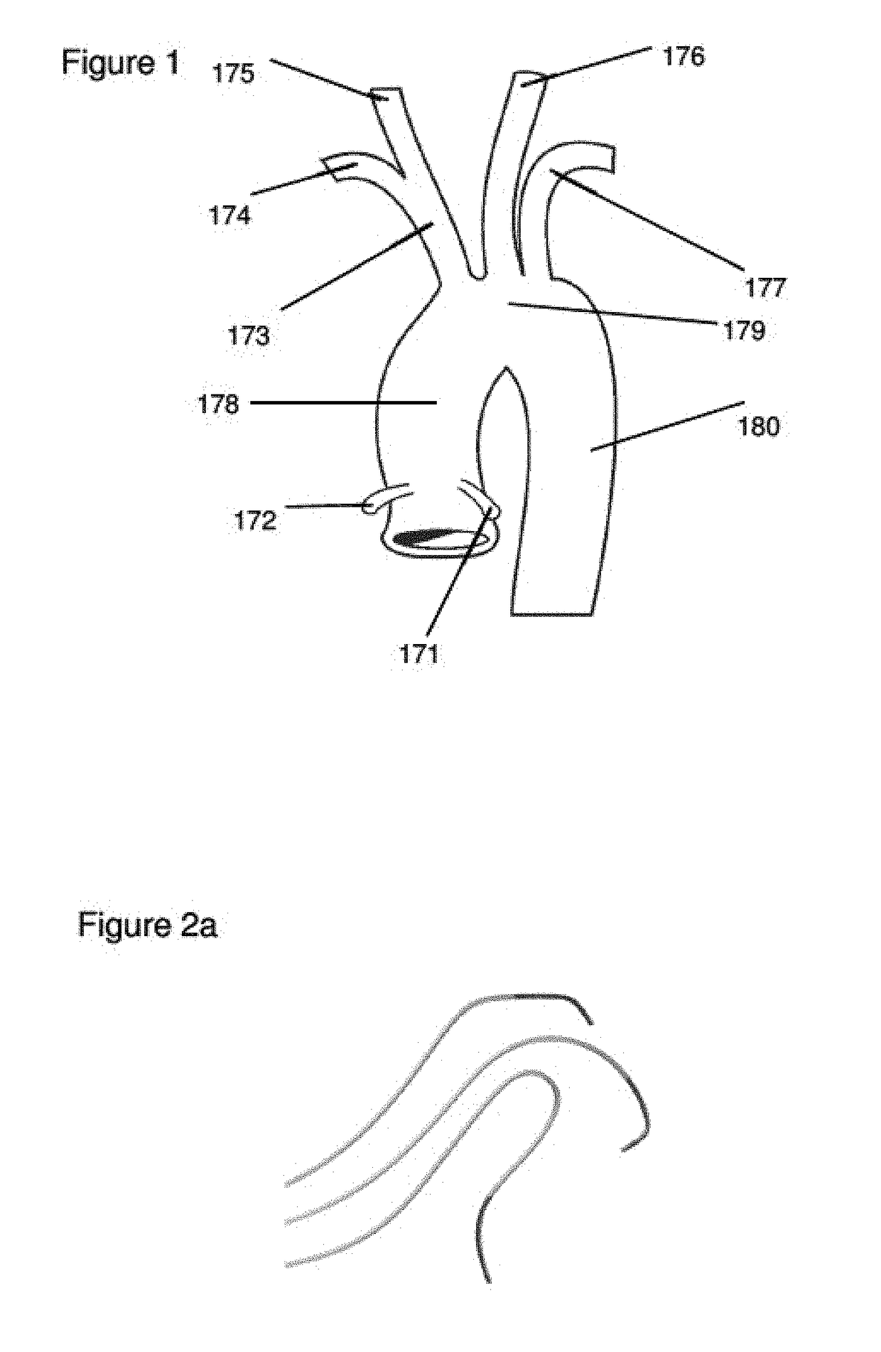 Systems and Methods for Routing a Vessel Line Such as a Catheter Within a Vessel