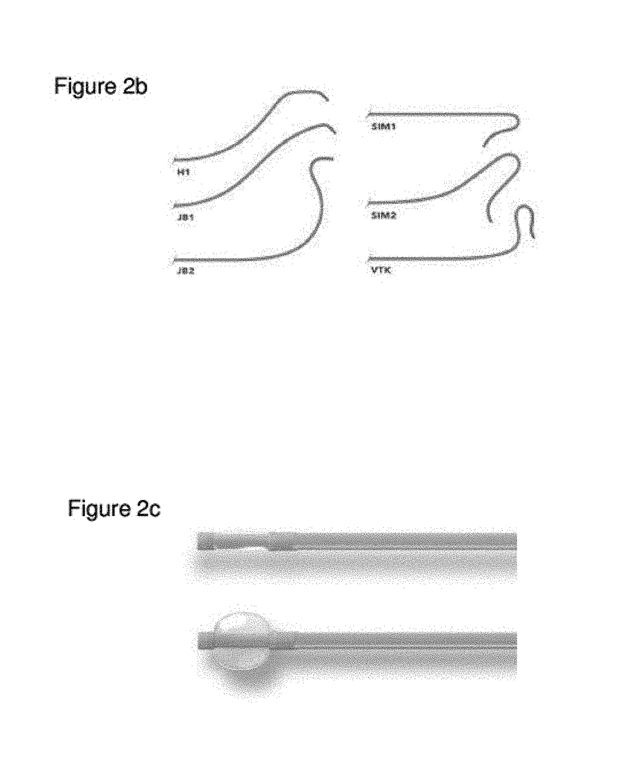 Systems and Methods for Routing a Vessel Line Such as a Catheter Within a Vessel