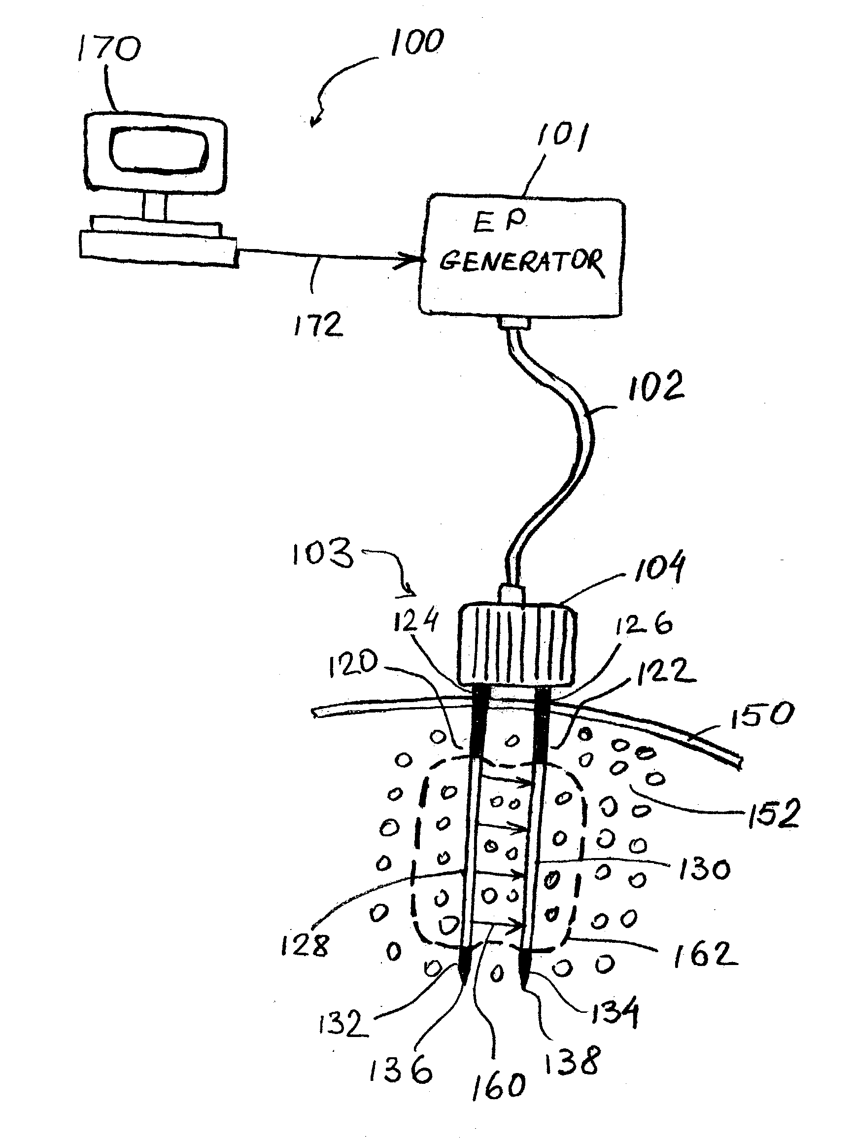 Apparatus and method for reducing subcutaneous fat deposits by electroporation