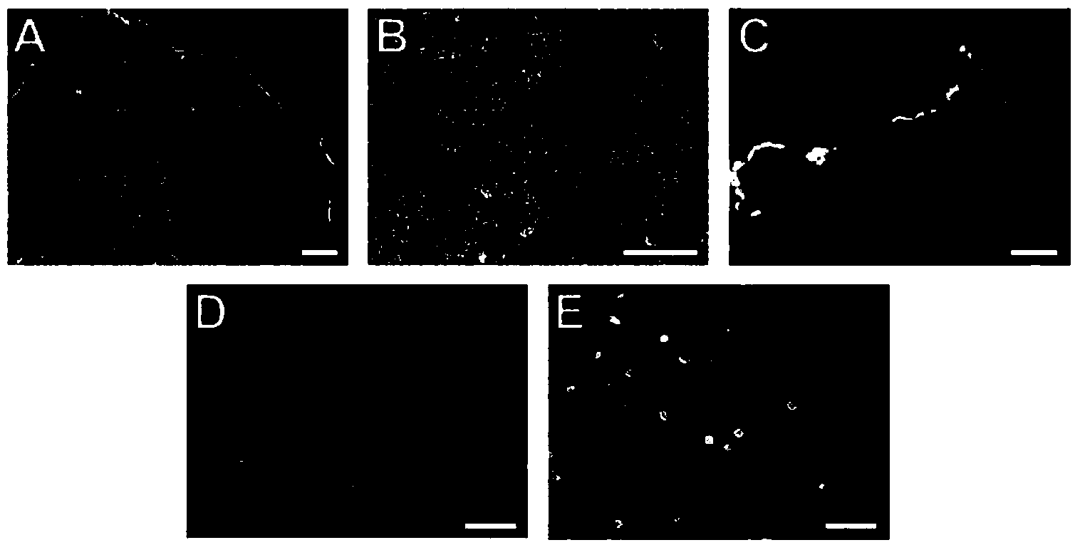 Culture medium and application thereof