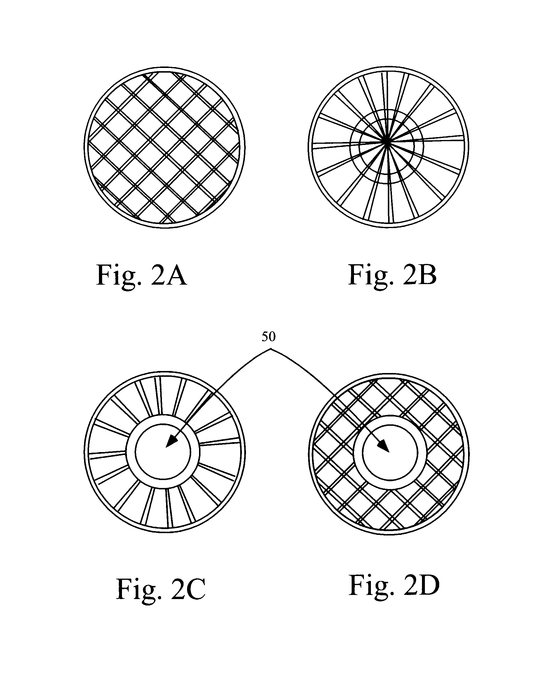 Intrastromal refractive surgery by inducing shape change of the cornea