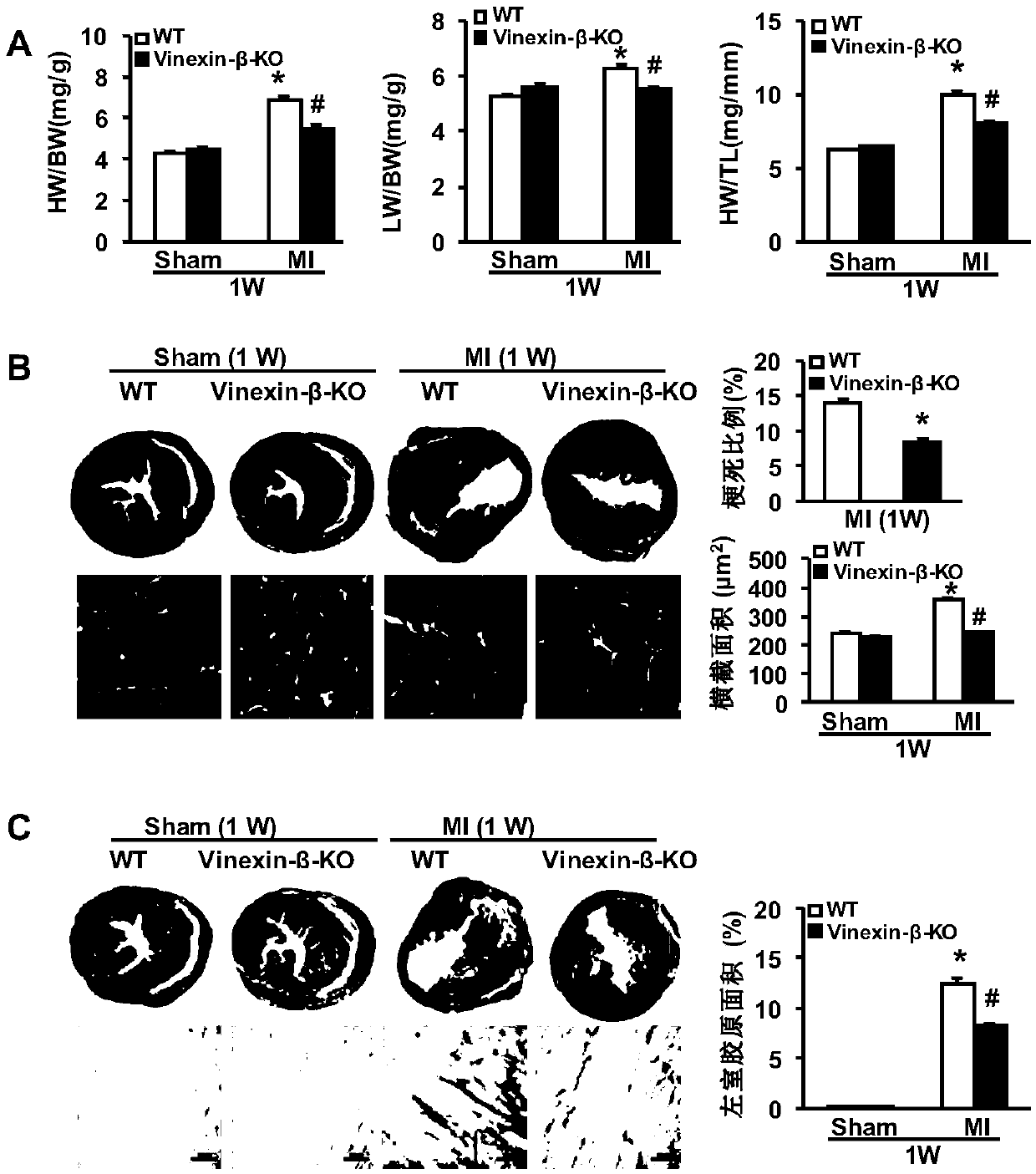 Application of vinexin-β gene in myocardial infarction