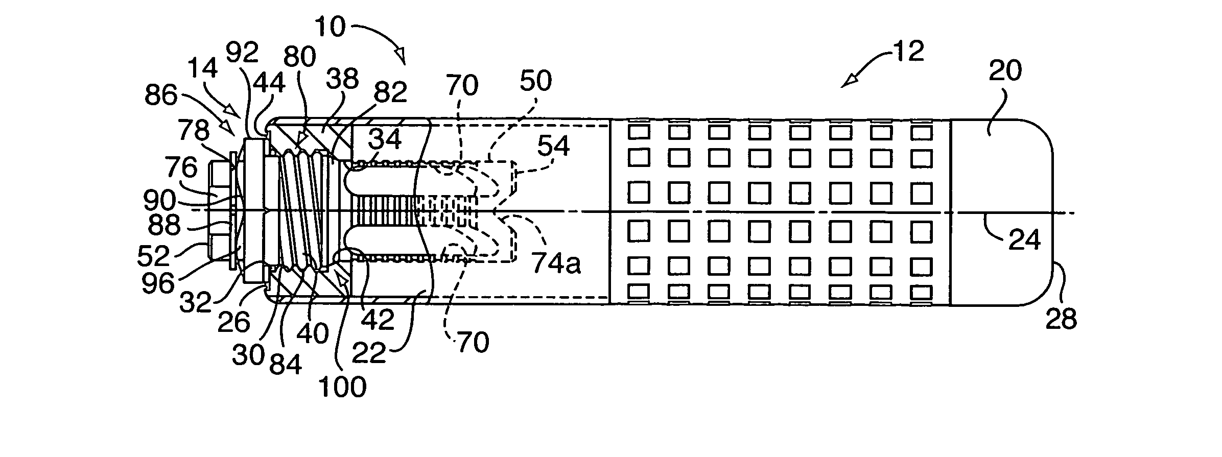 Muzzle attachment system