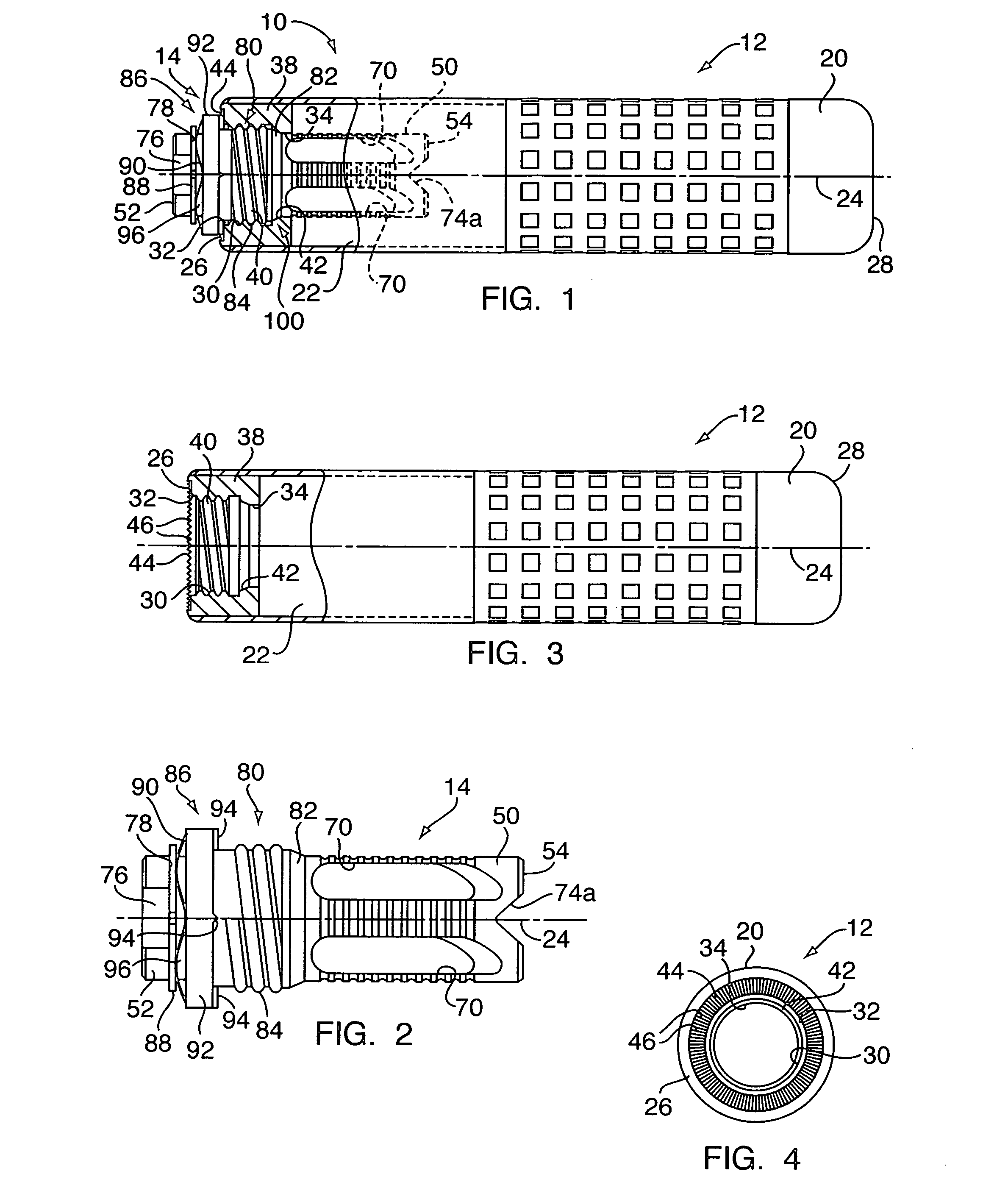 Muzzle attachment system