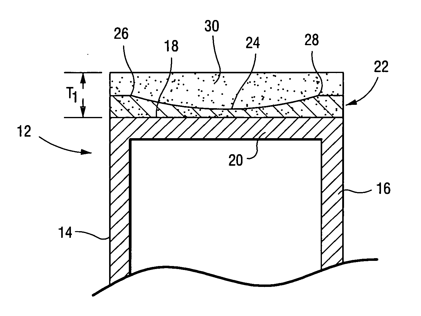 Steam-cooled gas turbine bucket for reduced tip leakage loss