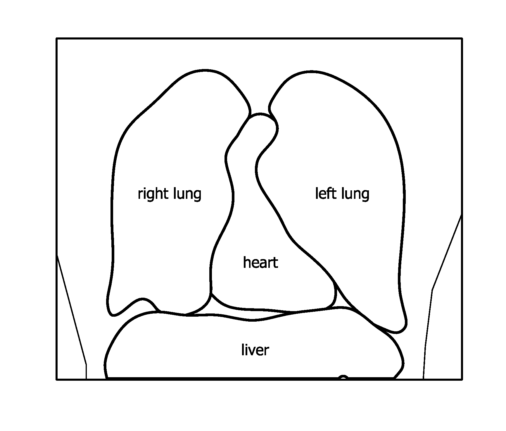 Method of retrieving data from a medical image data set