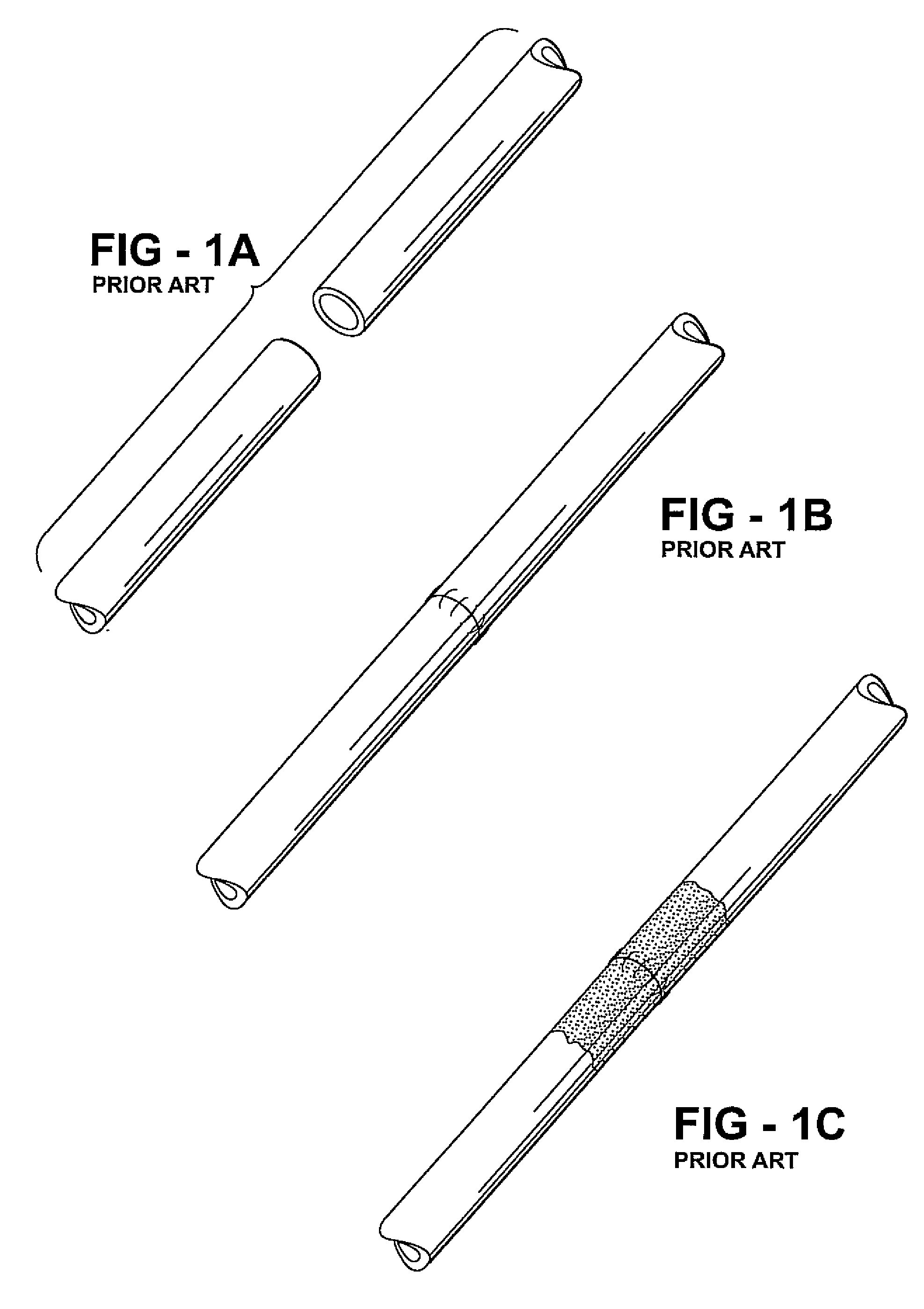 Sutureless vessel anastomosis method and apparatus