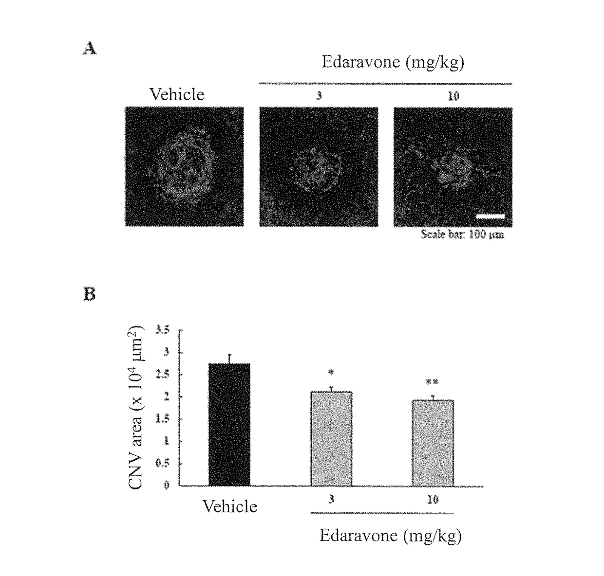 Agent for preventing and/or treating ophthalmologic diseases