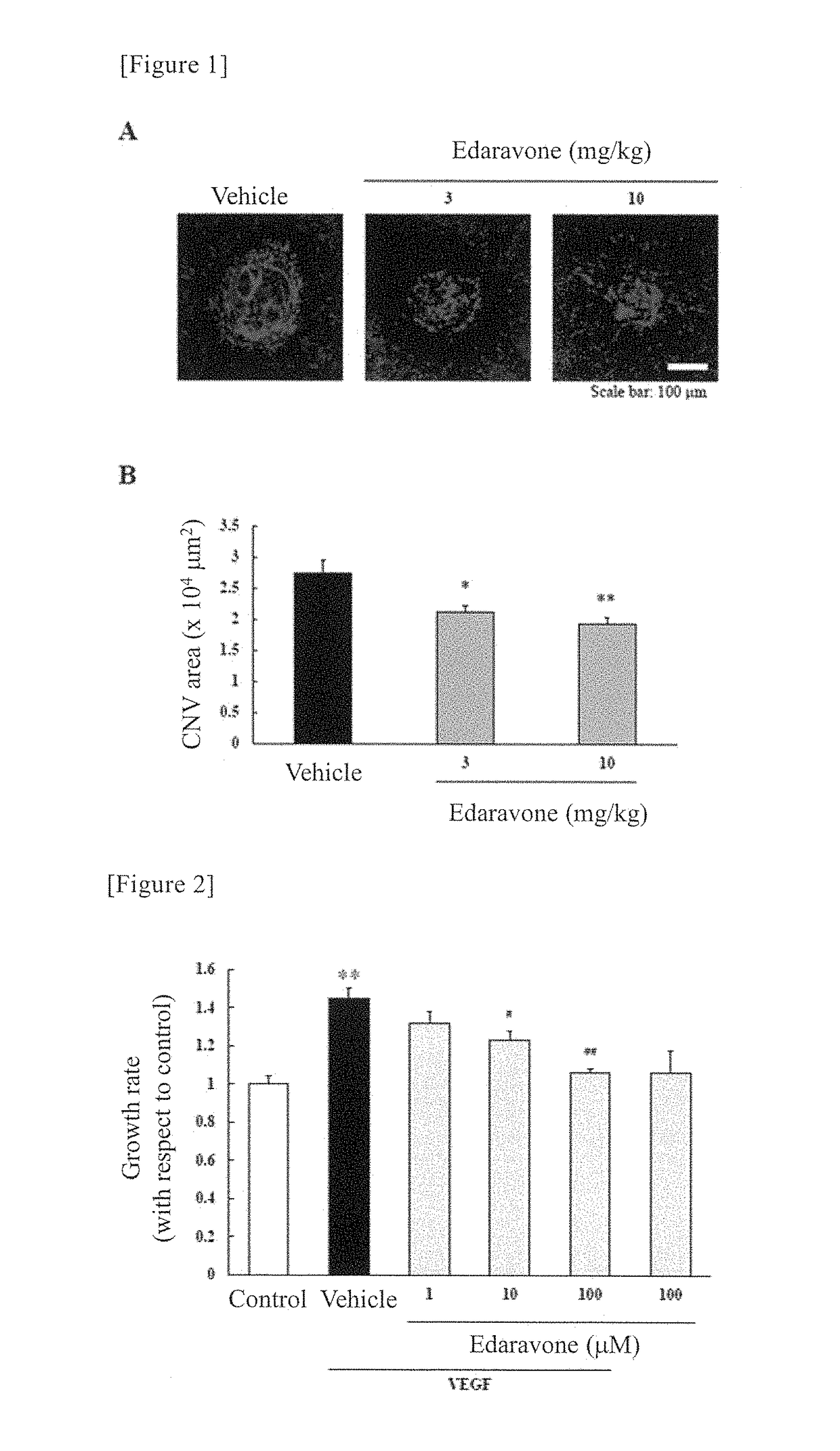 Agent for preventing and/or treating ophthalmologic diseases